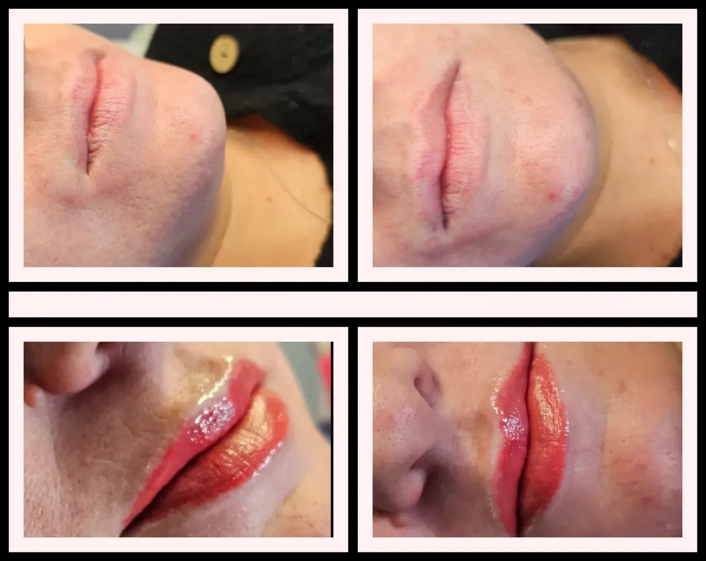 Lip blush shown before and after: pale, uneven lip colour replaced by a soft, even tint